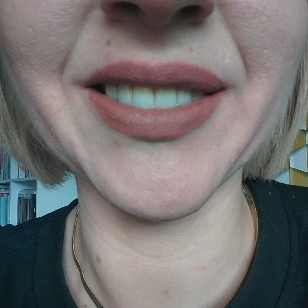 Glamora Dual Shade Lipliner
